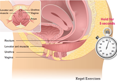 Kegal Excercises